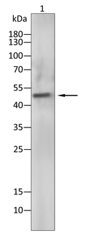 IL6R Antibody