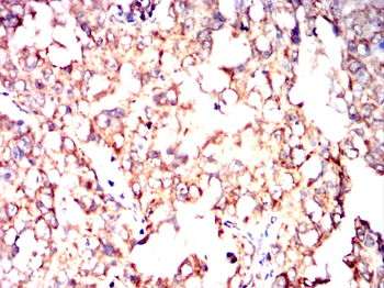 GOT2 Antibody