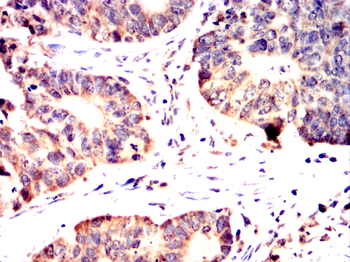 GOT2 Antibody