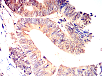 TUSC2 Antibody
