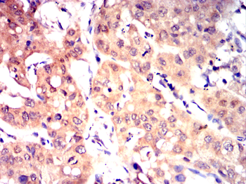 TUSC2 Antibody