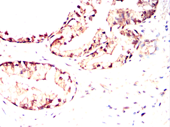 TUSC2 Antibody