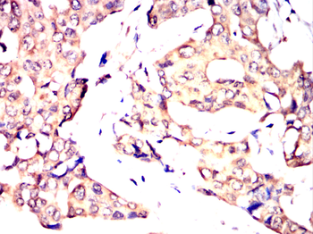 HLA-F Antibody