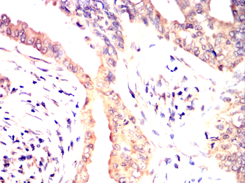 HLA-F Antibody
