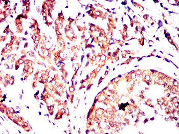 HLA-F Antibody