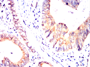 HLA-F Antibody