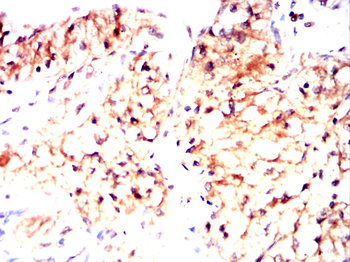 HLA-F Antibody