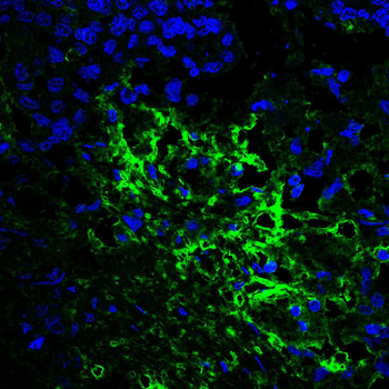 AKT2 Antibody