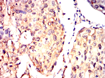 AKT2 Antibody