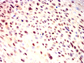 AKT2 Antibody
