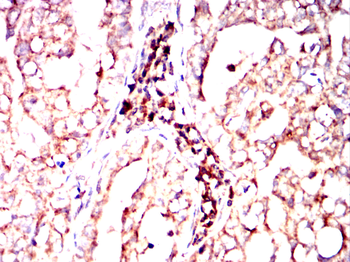 CD247 Antibody