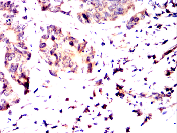 CD247 Antibody