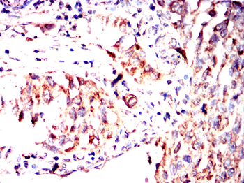 CD247 Antibody