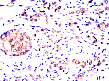 PTK7 Antibody