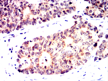 PTK7 Antibody