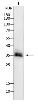 CDK20 Antibody