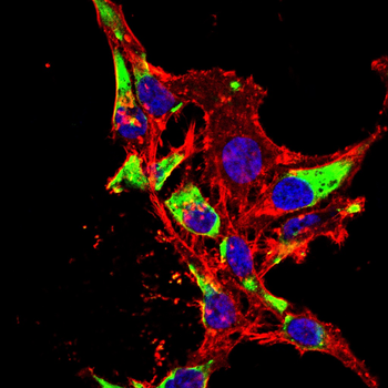 CDK20 Antibody