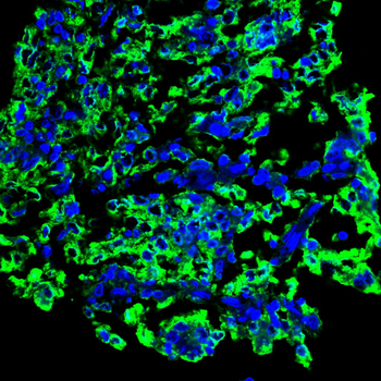 CDK20 Antibody
