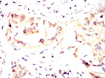 CDK20 Antibody