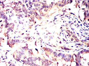 CDK20 Antibody
