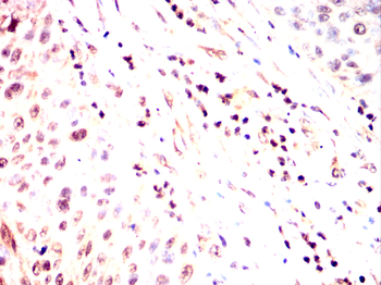 CDK20 Antibody