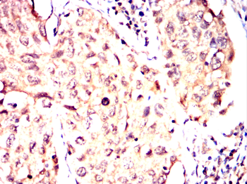 CDK20 Antibody