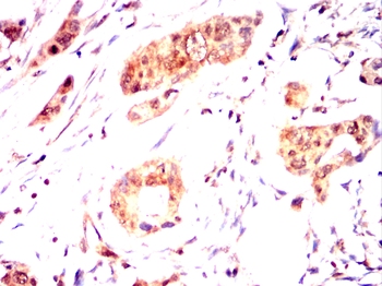 CDK20 Antibody
