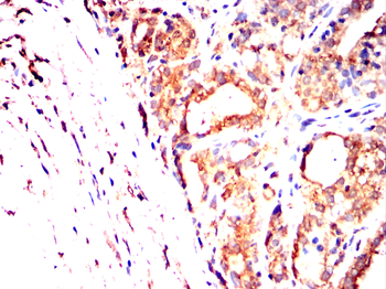 KLK2 Antibody