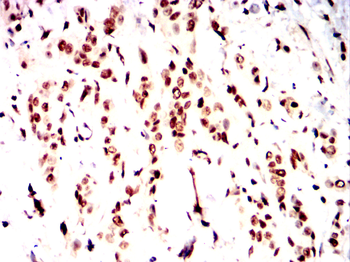 TCF3 Antibody