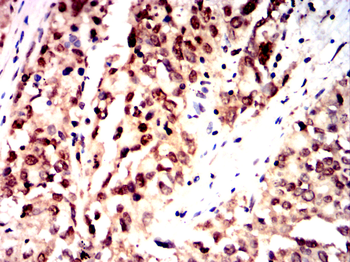 TCF3 Antibody