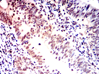 TCF3 Antibody