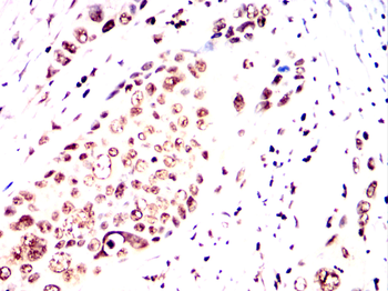 TCF3 Antibody