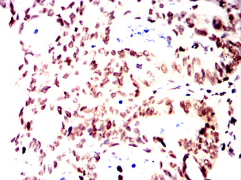 ZBTB16 Antibody