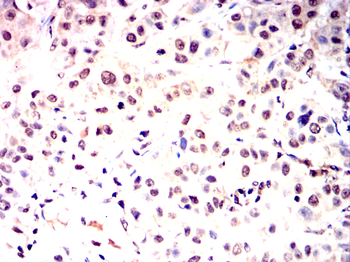 ZBTB16 Antibody