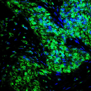 ZBTB16 Antibody