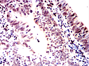 ZBTB16 Antibody