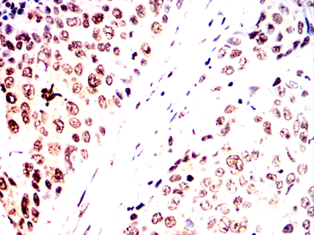 ZBTB16 Antibody