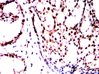 YEATS4 Antibody