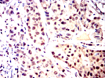 YEATS4 Antibody