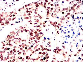 YEATS4 Antibody