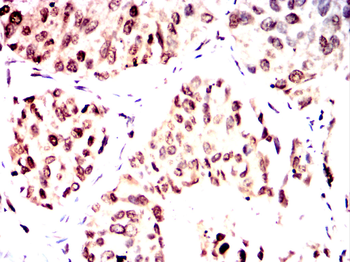 YEATS4 Antibody