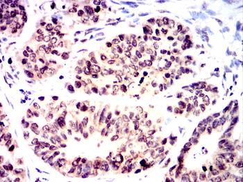 YEATS4 Antibody