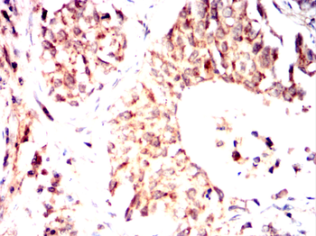 USP14 Antibody