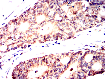 USP14 Antibody