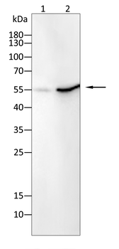 USP14 Antibody