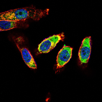 CAMKK2 Antibody