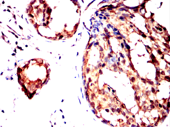 CAMKK2 Antibody