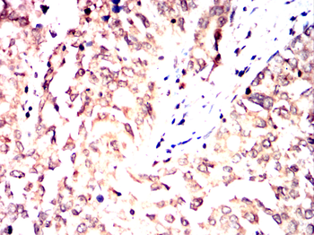 CAMKK2 Antibody