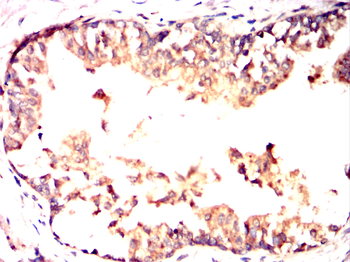 CAMKK2 Antibody
