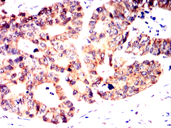 CAMKK2 Antibody